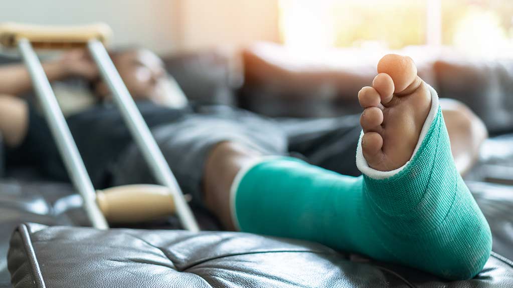 Injured leg in cast